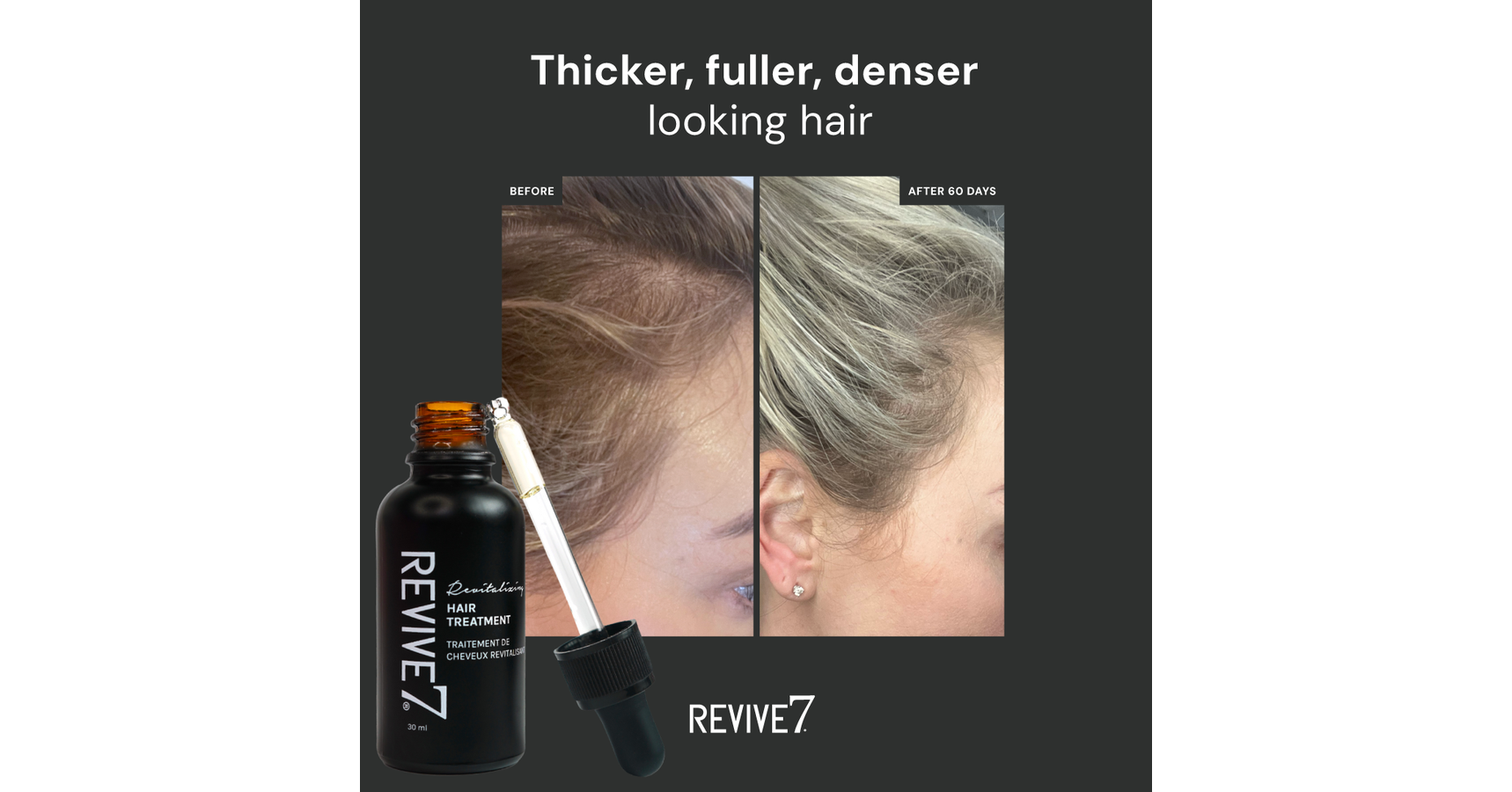 Revive7 Hair Treatment