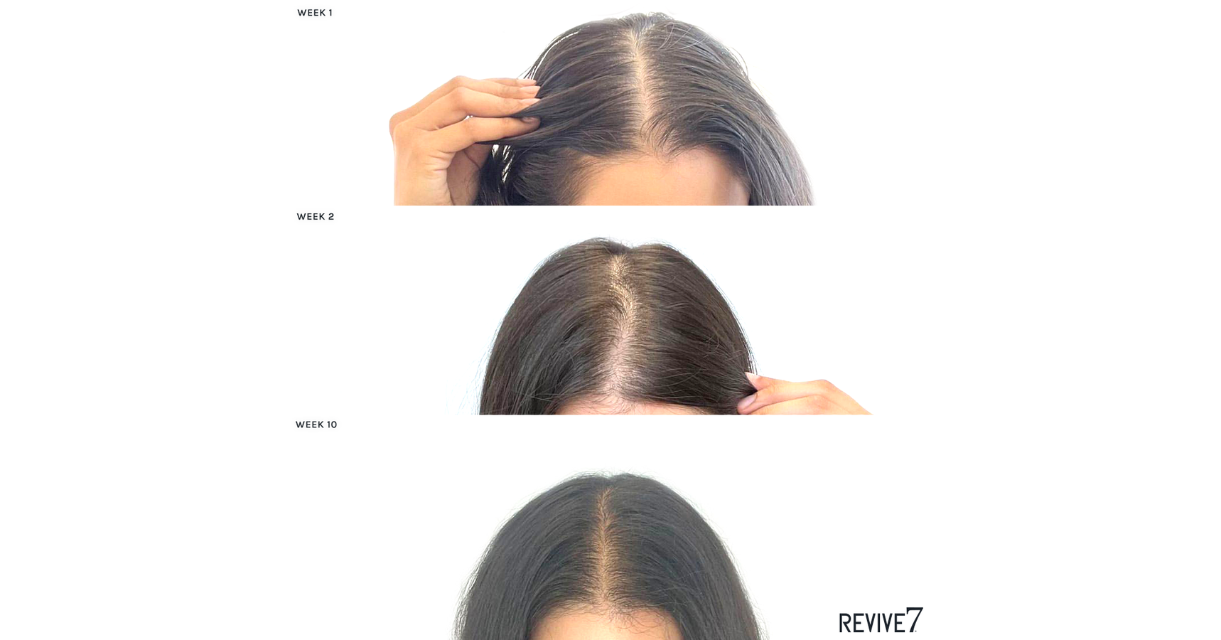 Revive7 Hair Treatment