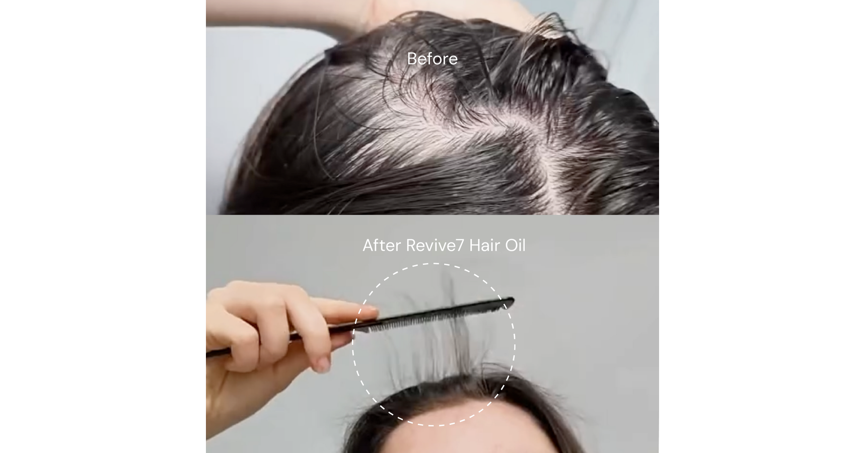 Revive7 Hair Treatment