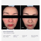 ADOREYES ExoScript MD™ Biomimetic Renewal Face Serum (20ml)