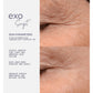 ADOREYES ExoScript MD™ Biomimetic Renewal Face Serum (20ml)