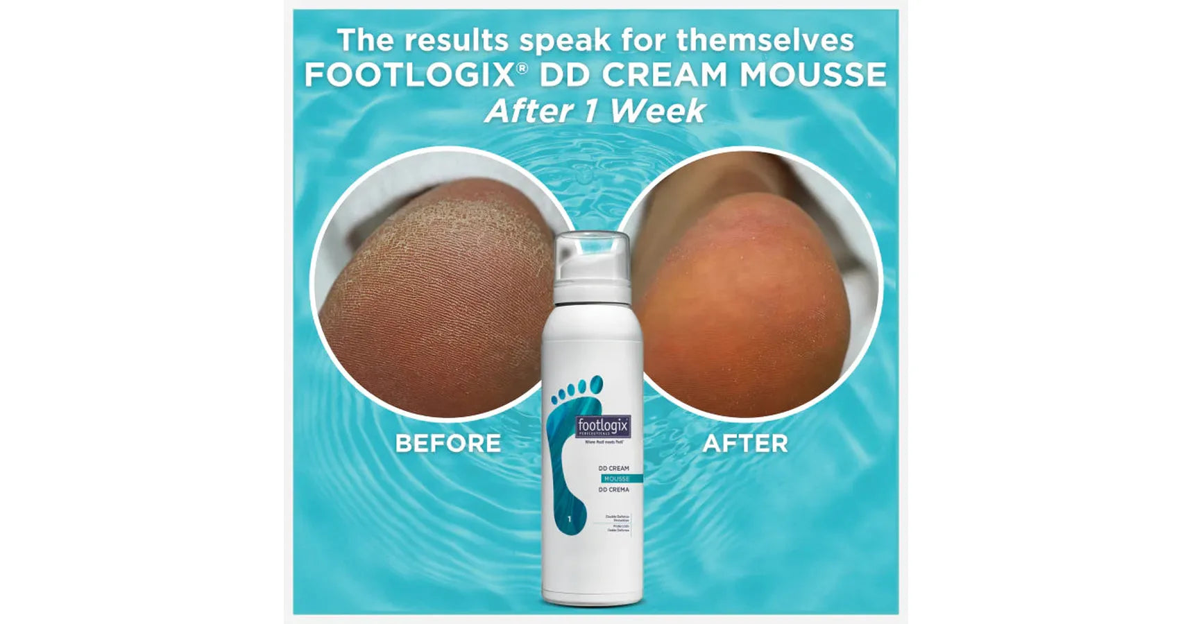 Footlogix Day & Night Essential Kit