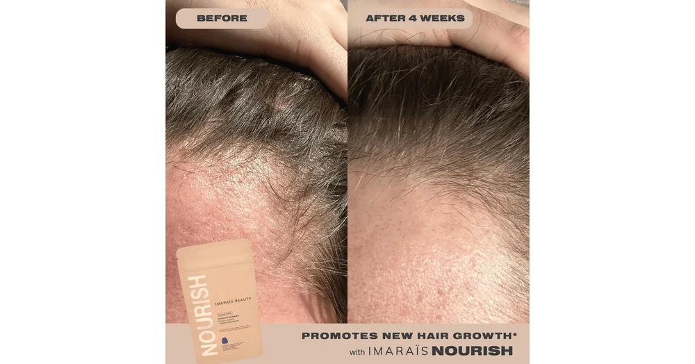 Imarais Vegan Haircare Gummies - NOURISH (30/pack)