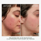 Fitglow Redness Rescue Cream (RRC) (45ml)