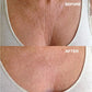 Wrinkles Schminkles CHEST Patch - reusable (1/pack)